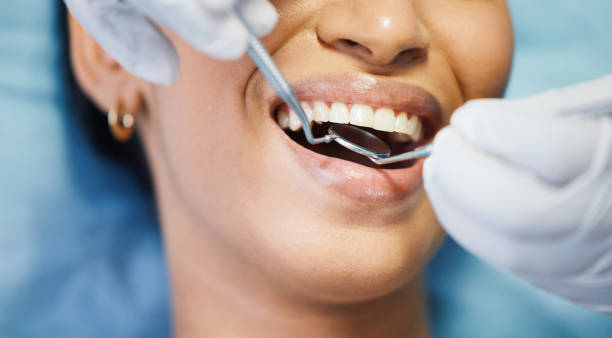 Best Emergency Dental Extractions in Grand Ledge, MI